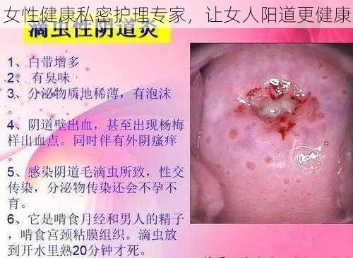 女性健康私密护理专家，让女人阳道更健康